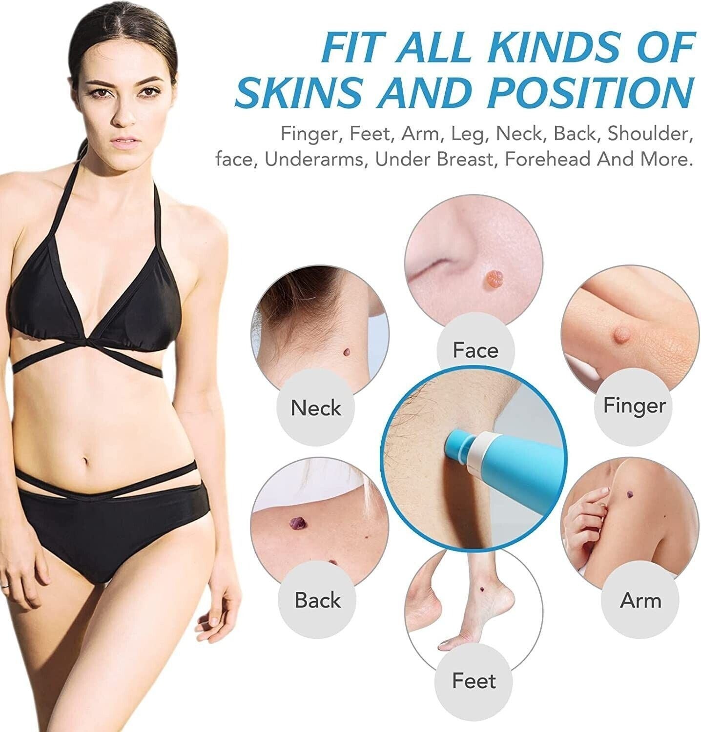 Skin-Tag Remover Double Headed Pen Set