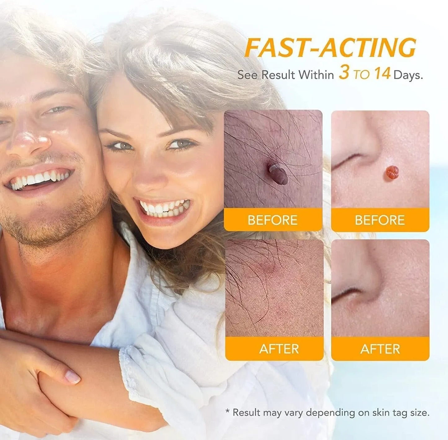 Skin-Tag Remover Double Headed Pen Set